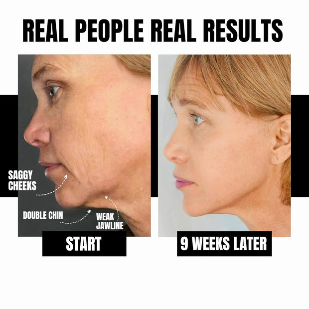 Face Sculpting Gym Kit – 4 Tools for a Complete Facial Workout